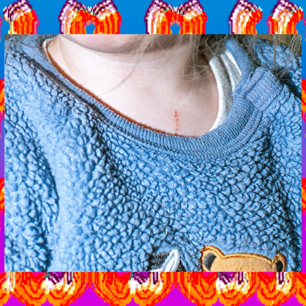 Yes Eyes Slush Around a&nbsp;Little